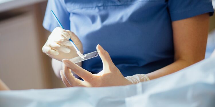 Como o câncer do colo do útero é diagnosticado?