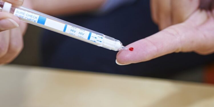 Posso confiar no resultado do autoteste de HIV?