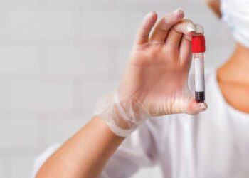 As infecções sexualmente transmissíveis estão aumentando: devo me preocupar