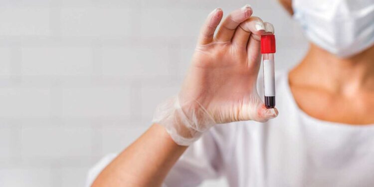 As infecções sexualmente transmissíveis estão aumentando: devo me preocupar